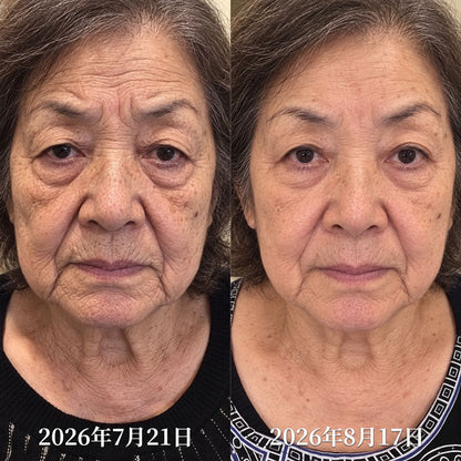 ⏰𝐇𝐞𝐚𝐥𝐫𝐢𝐳𝐞® ✅ 𝐏𝐃𝐑𝐍 エイジングケア スポット美容スティック