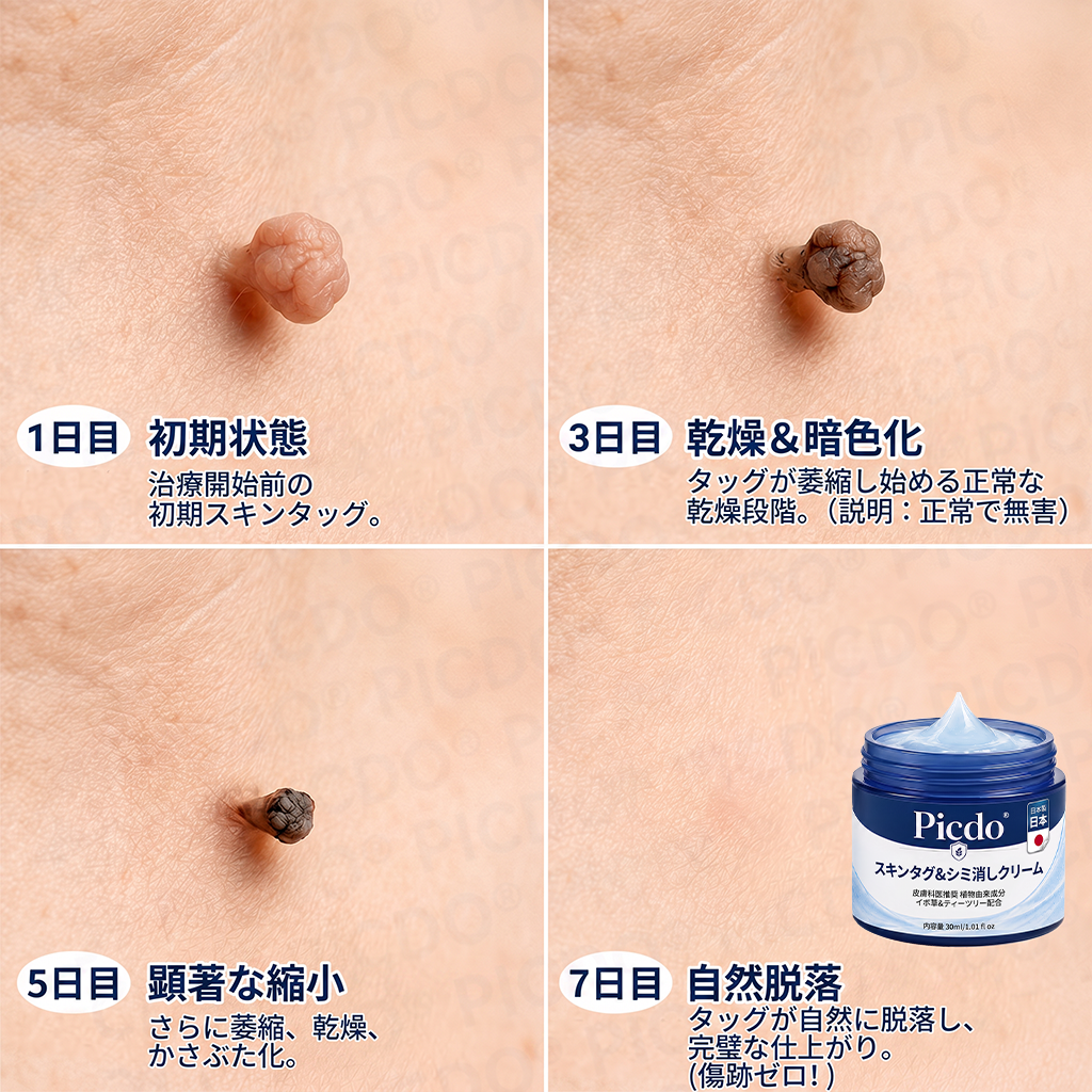 ⏰𝐏𝐢𝐜𝐝𝐨® 7日間スキー＆スポットエクササイズクリーム🩵