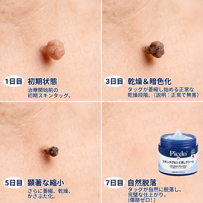 ⏰𝐏𝐢𝐜𝐝𝐨® 7日間スキー＆スポットエクササイズクリーム🩵