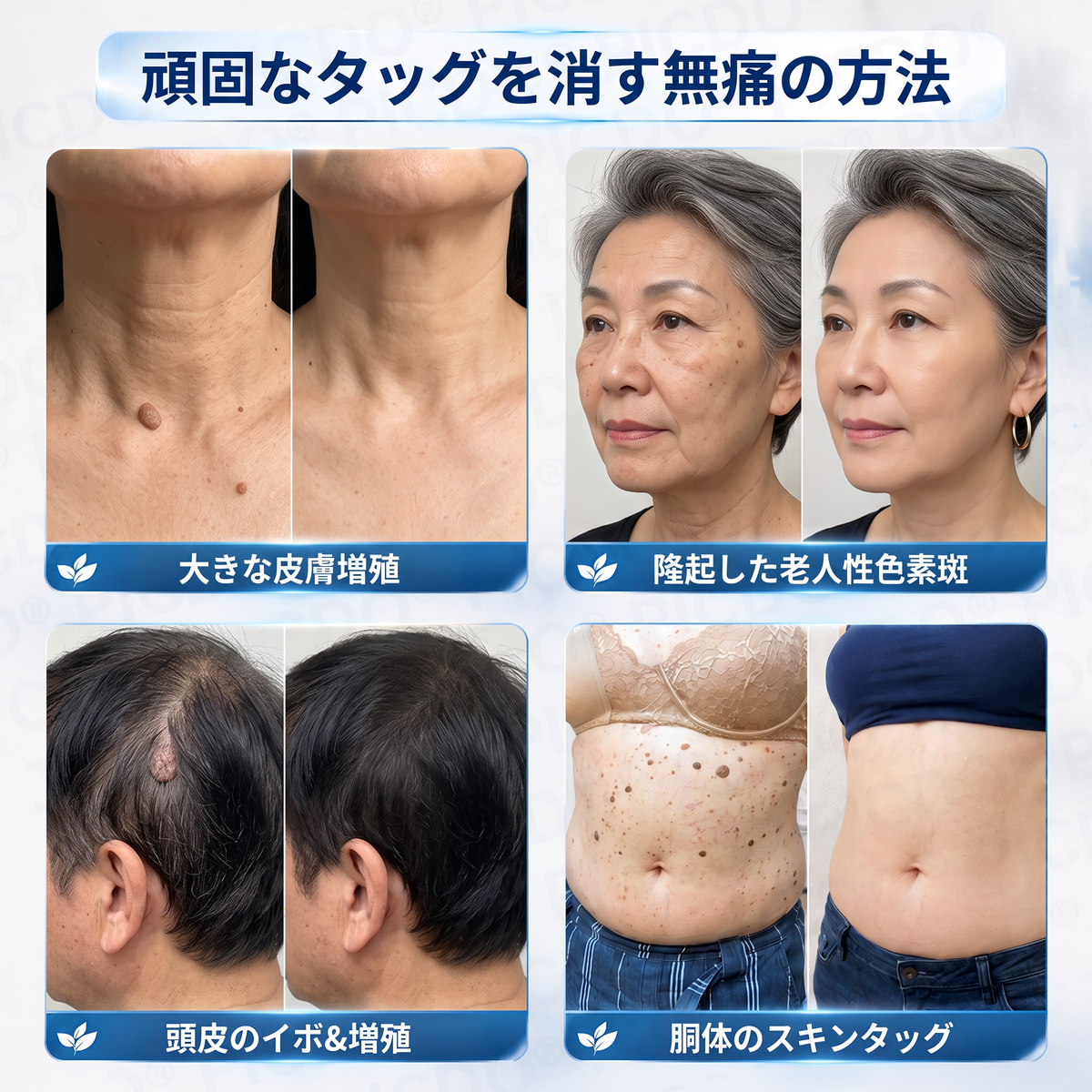 ⏰𝐏𝐢𝐜𝐝𝐨® 7日間スキー＆スポットエクササイズクリーム🩵