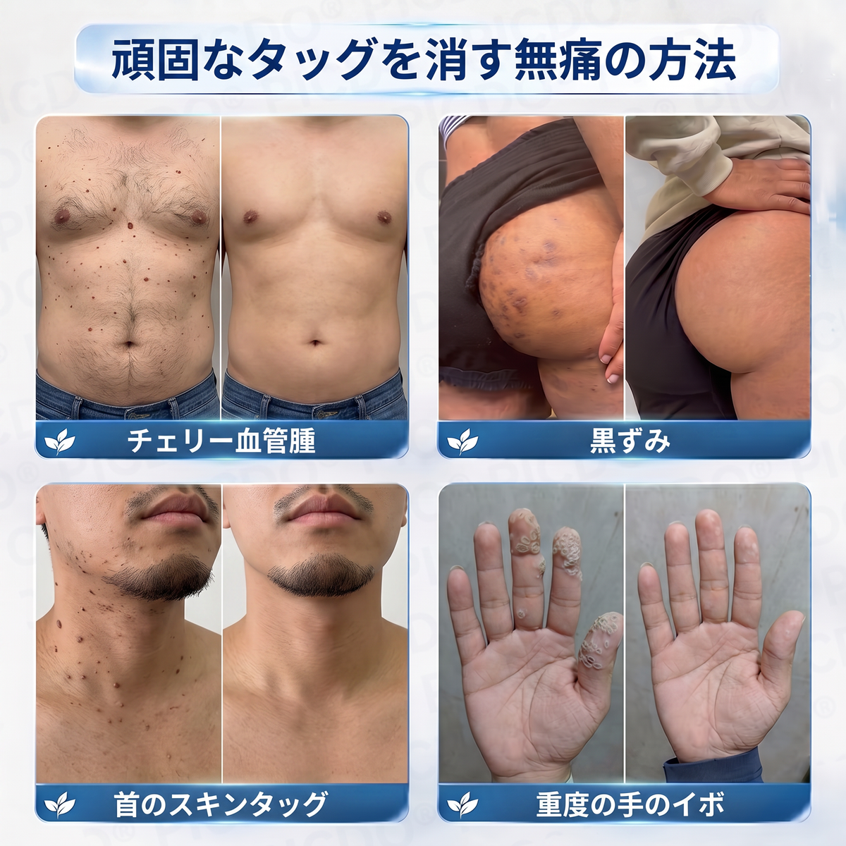 ⏰𝐏𝐢𝐜𝐝𝐨® 7日間スキー＆スポットエクササイズクリーム🩵